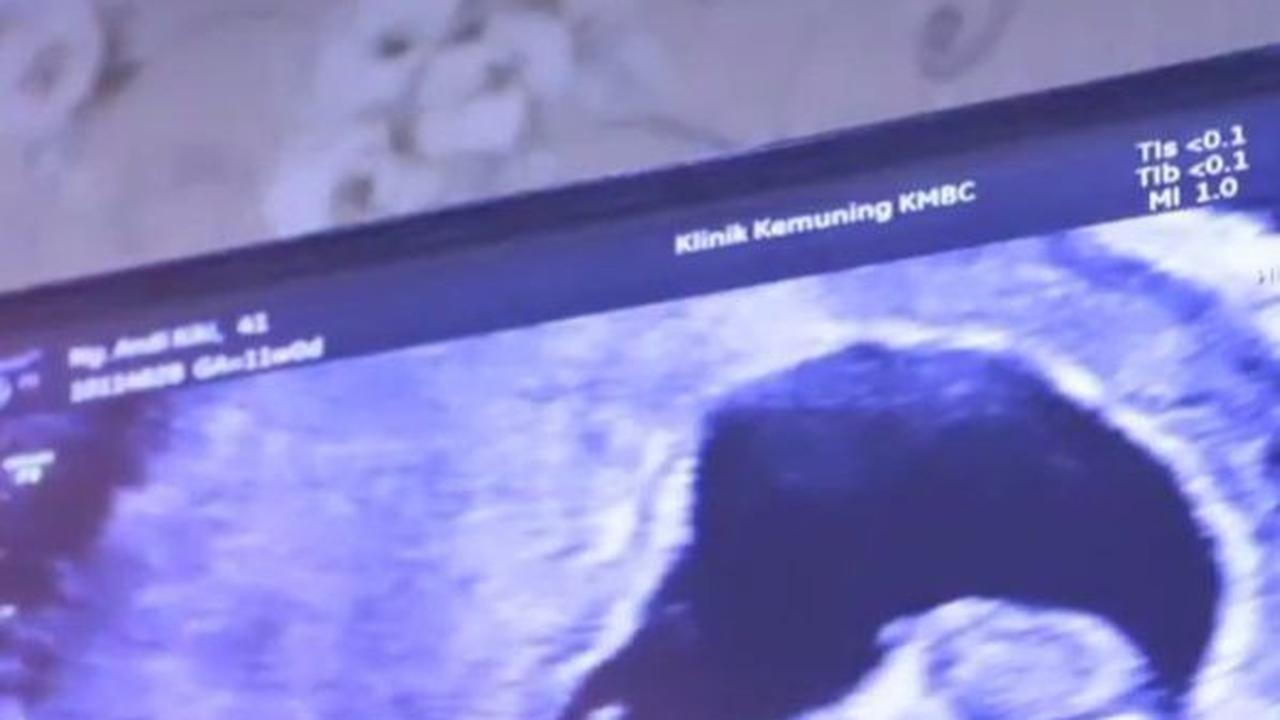 Kiki Amalia sedang mengandung anak pertama dari pernikahannya dengan Agung Nugraha, dengan usia kehamilan saat ini mencapai 15 minggu.
