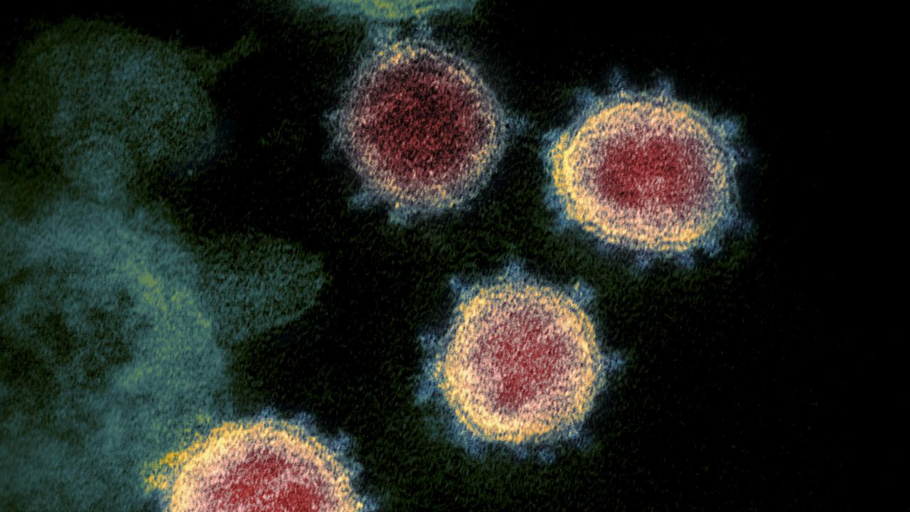 Gambar ilustrasi ini dengan izin dari National Institutes of Health pada 27 Februari 2020. Menunjukkan mikroskopis elektron transmisi SARS-CoV-2 juga dikenal sebagai 2019-nCoV, virus yang menyebabkan Corona COVID-19. (AFP/National Institutes of Health).