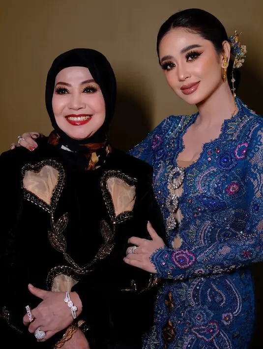 Dewi Perssik juga mengunggah potret bersama sang ibunda. Keduanya pun tampak sama-sama cantik. [@dewiperssik9]