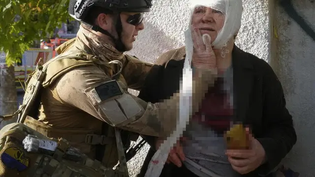Seorang wanita paruh baya terluka akibat serangan Rusia di Kyiv, Ukraina.