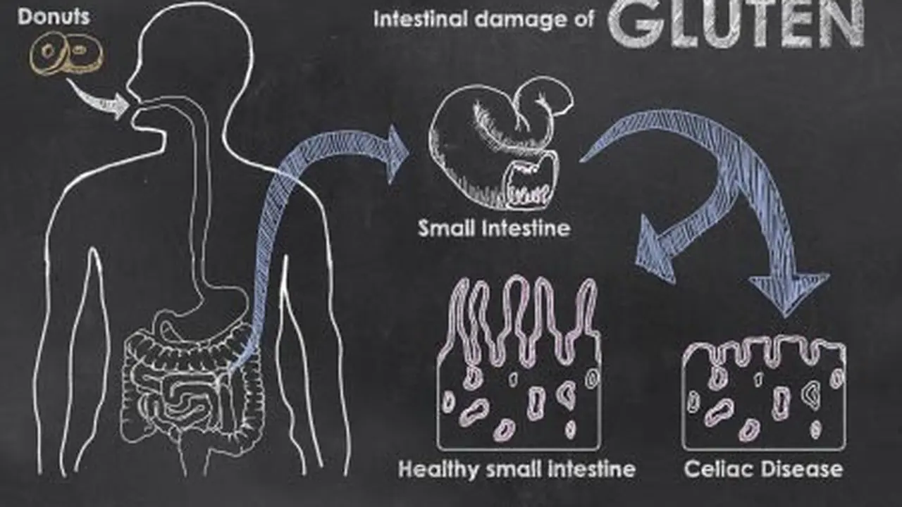 Inilah Tanda-tanda Anda Mengalami Intoleransi Gluten