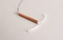 Benarkah KB IUD Picu Depresi? Fakta, Studi, dan Cara Mengatasi Perubahan Mood