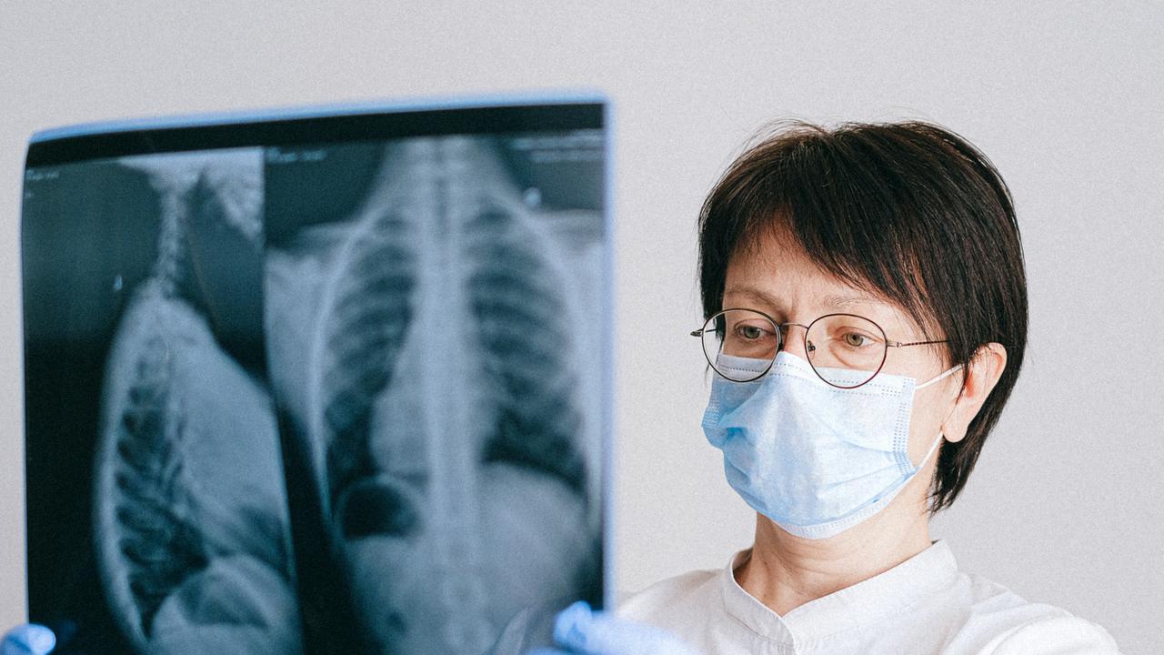 Ilustrasi Hipertensi Paru