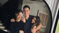 10 Potret Rumah Nana Mirdad di Bali Bergaya Modern Tropis, Nyaman dan Asri