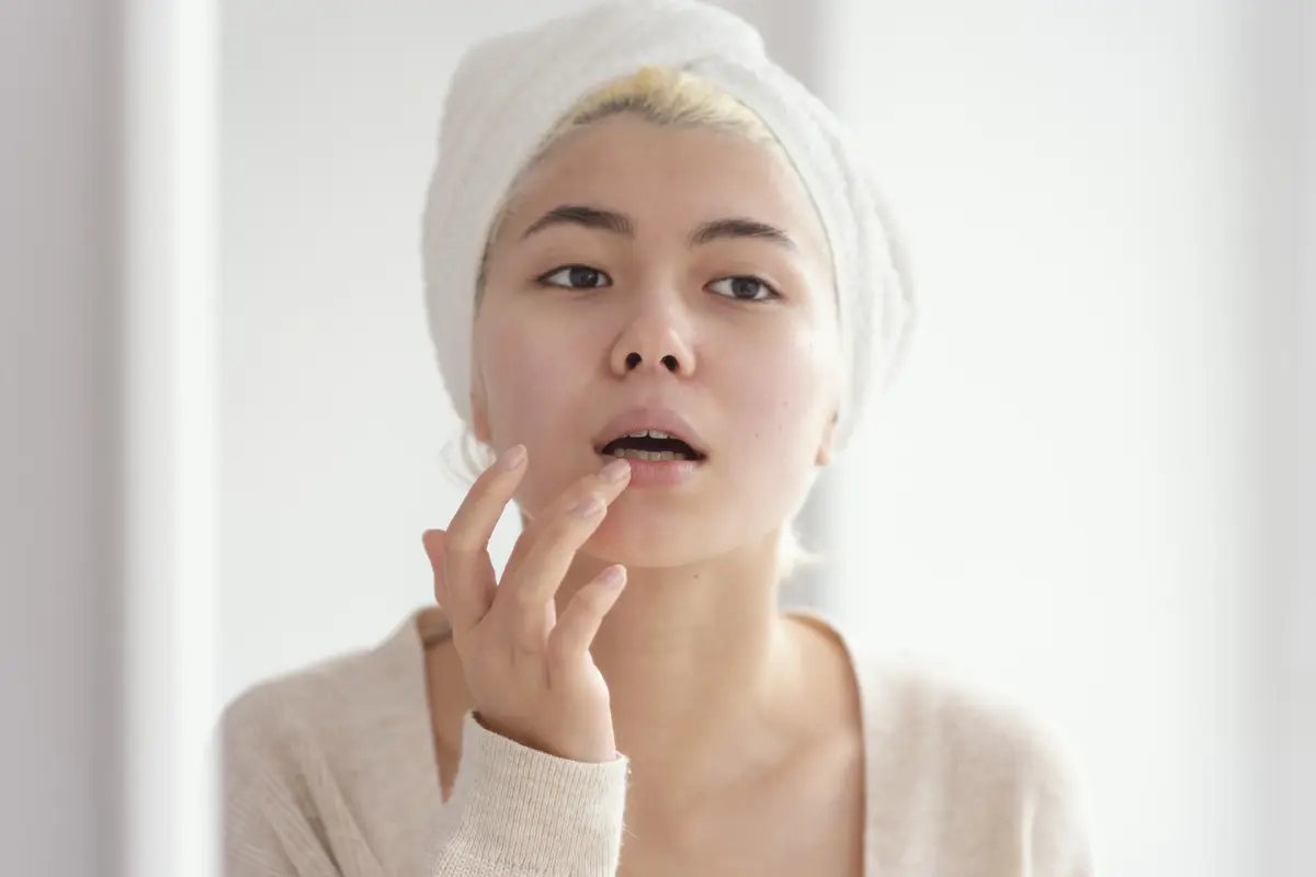 Ilustrasi bibir kering