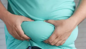 Orang Dewasa Obesitas di Inggris Meningkat, Ini Penyebabnya