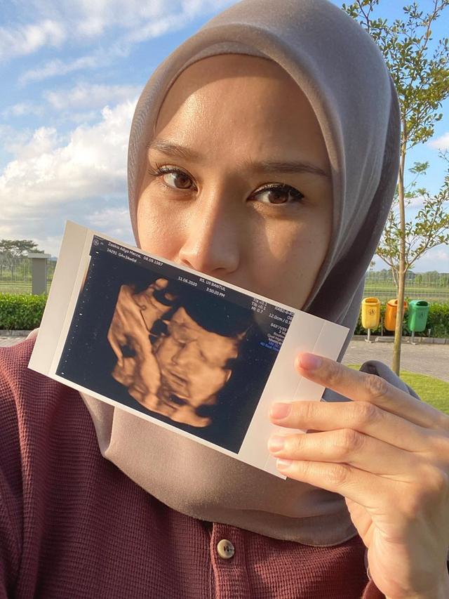 Arti Nama Anak Kelima Zaskia Adya Mecca Indah Banget Ini Penjelasan Hanung Bramantyo Showbiz Liputan6 Com
