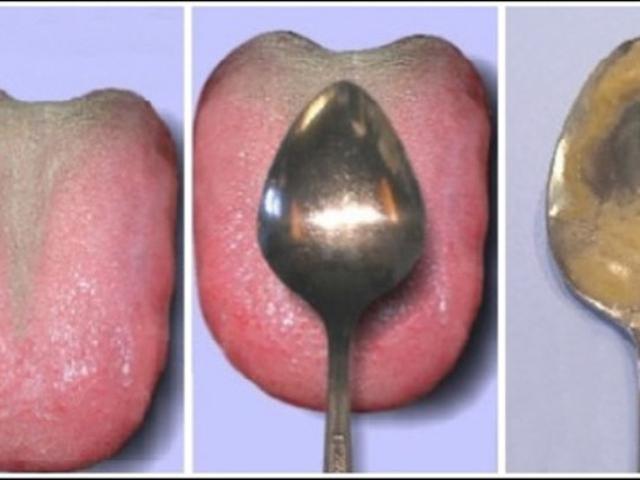 Cara Mudah Cek Kesehatan Organ Dalam Dengan Sendok Makan Citizen6 Liputan6 Com