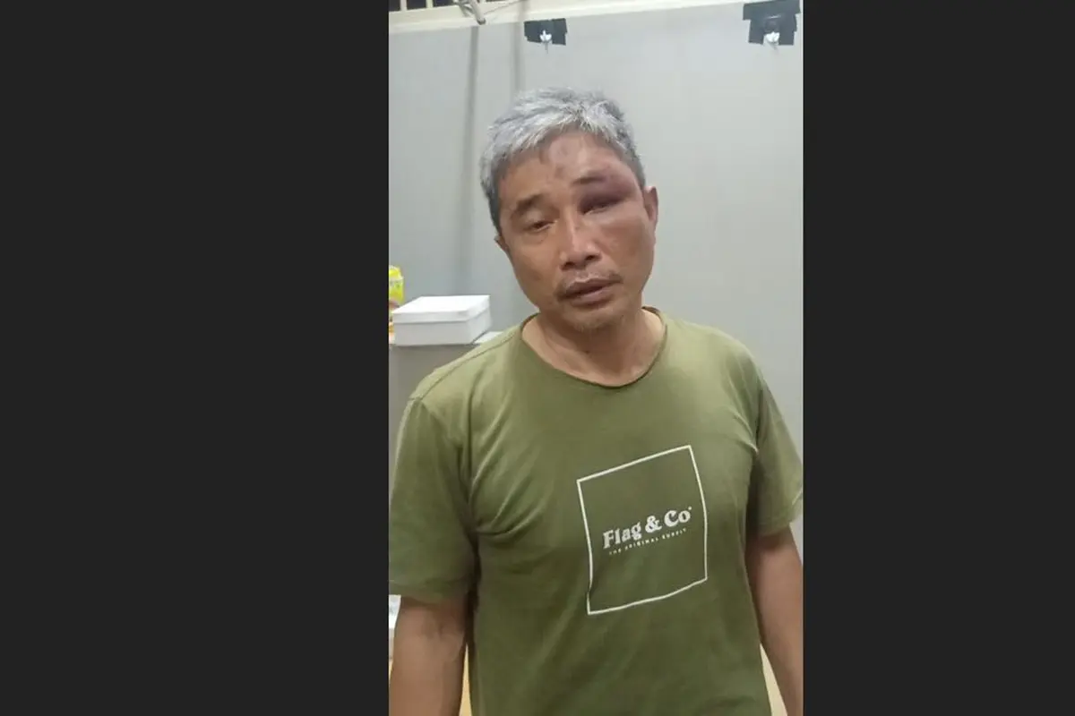 Foto terbaru Muhammad Kece dengan wajah lebam beredar di aplikasi perpesanan.