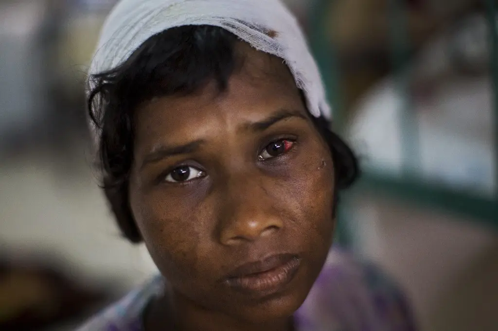 Dildar Begum, perempuan Rohingya mengaku menjadi korban penusukan akibat serangan militer Myanmar di Rakhine, tengah mendapat perawatan di rumah sakit di Cox Bazar, Bangladesh. Kepada AP, ia menuturkan, suaminya tewas akibat serangan tersebut (AP)