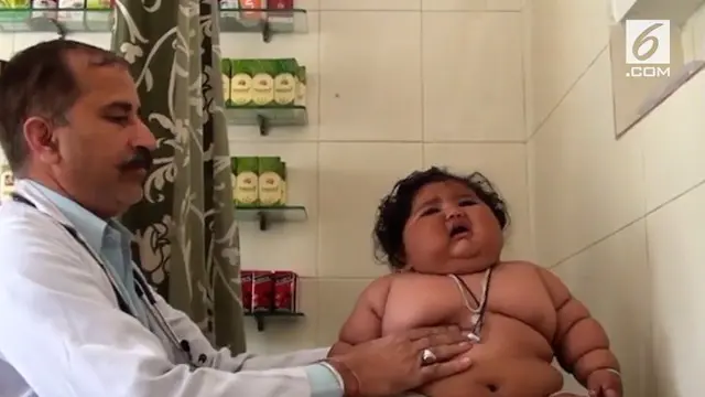 Seorang bayi Perempuan asal India alami obesitas parah. Bobotnya mencapai 17 kg saat ia masih berusia 8 bulan.