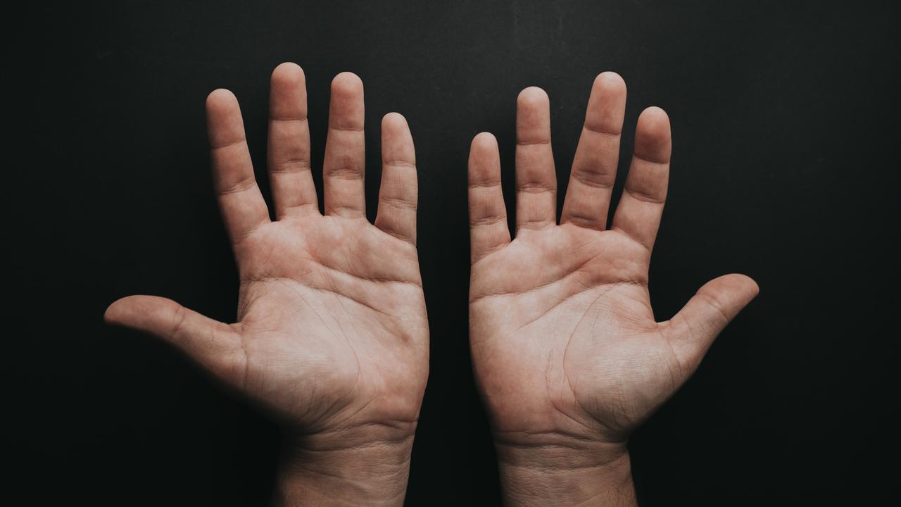 Ilustrasi tangan gatal. Photo by Luis Quintero on Unsplash