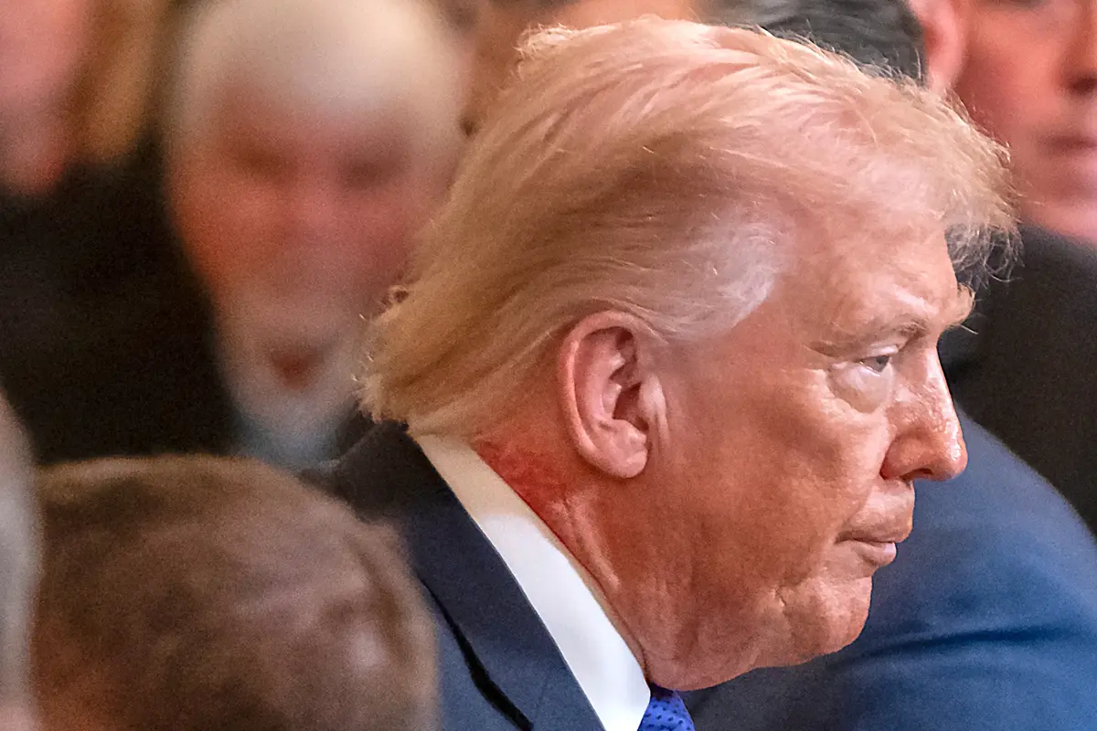 Ruam merah pada leher Donald Trump jadi sorotan. (Foto: AP Photo/Mark Schiefelbein)