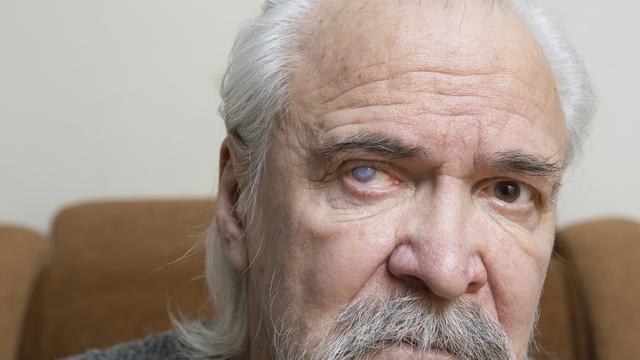 Gastritis Adalah Peradangan di Dinding Lambung, Kenali Gejala dan Penyebabnya