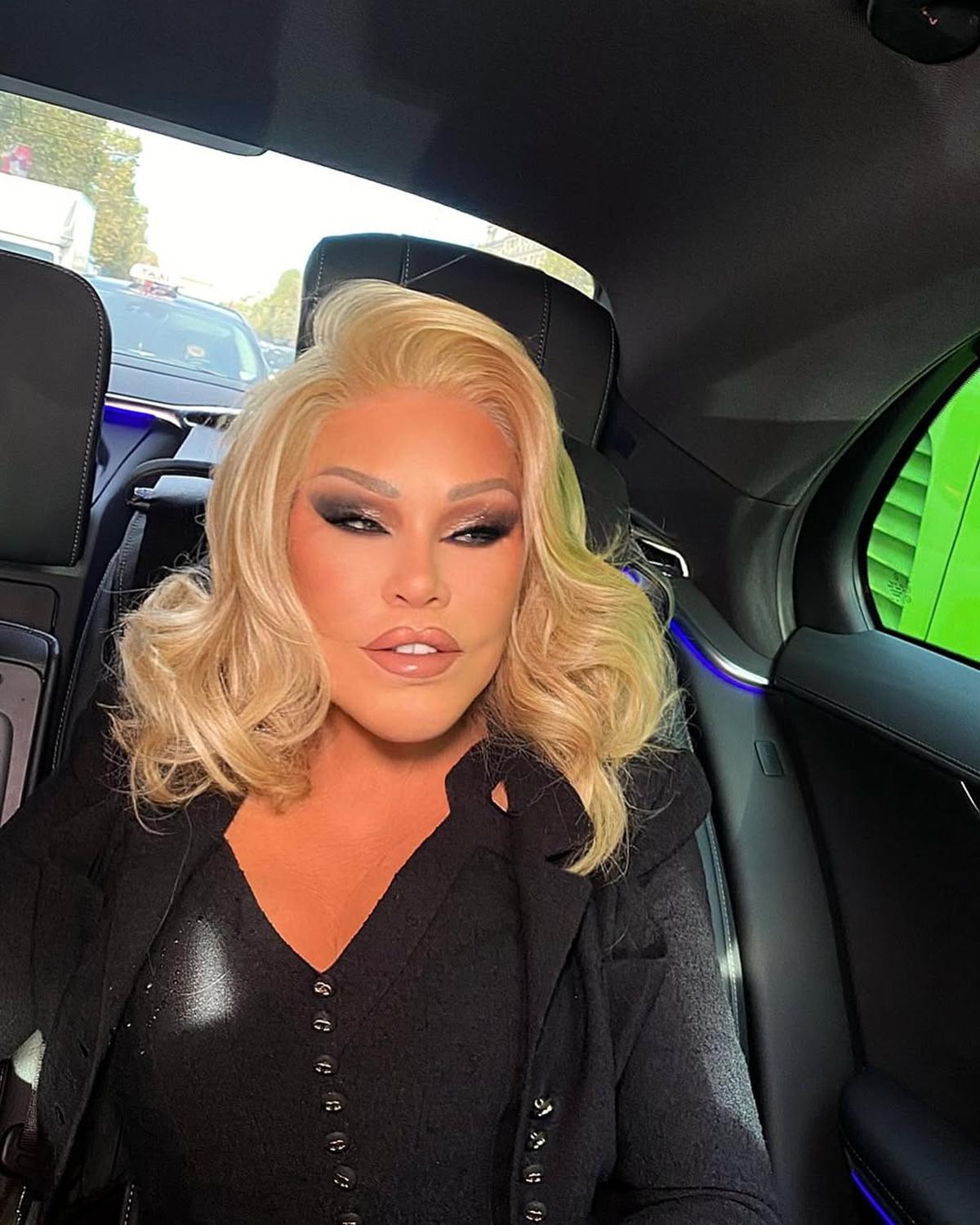 Jocelyn Wildenstein, Perempuan Berjuluk Catwoman Meninggal Dunia