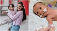 6 Potret Kondisi Anzel Anak Audi Marissa ketika Lahir Prematur, Kini Genap 3 Tahun