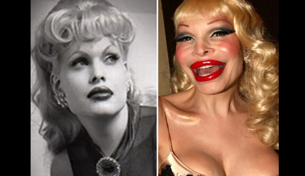 Amanda Lepore adalah seorang transgender. Ia telah menjalani operasi untuk menjadi wanita cantik sejak umur 15 tahun. Namun operasi terakhirnya malah menjadikan ia mirip The Joker musuhnya Batman (Istimewa)