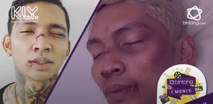 Tak lama setelah Young Lex dikabarkan mengalami pengeroyokan oleh fans Kpop di acara Meet and Greet Lisa BLACKPINK berbagai bukti pun satu-persatu mulai mencuat.