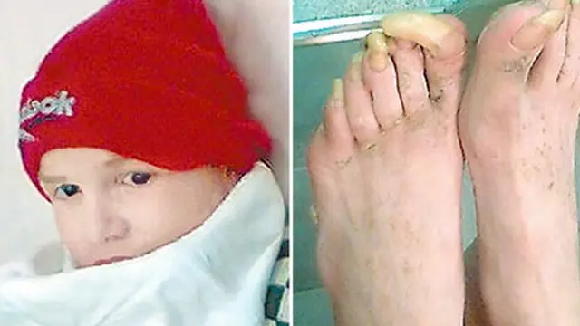 7 Anak (Malang) yang Dibesarkan Binatang