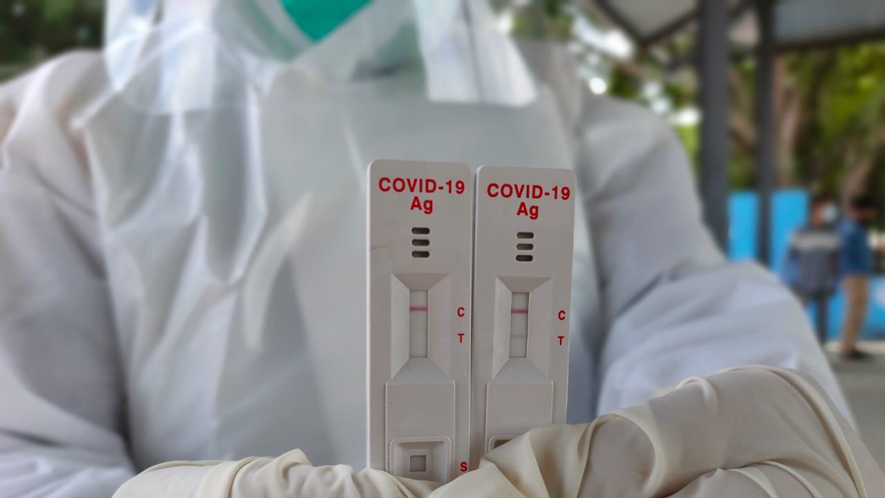 Keunggulan Rapid Test Antigen Tangani Covid-19 di Musi Banyuasin
