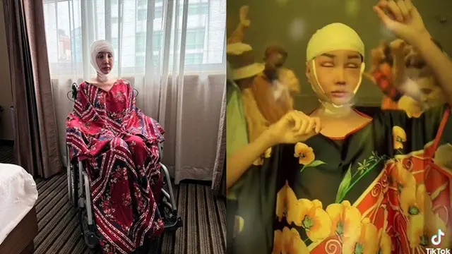 6 Potret Lucinta Luna Belajar Berdiri Usai Operasi Gergaji Rahang dan Potong Tulang Ekor