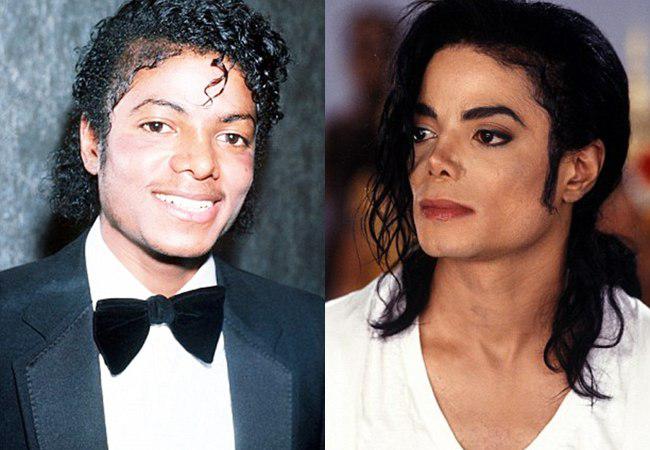 Perubahan penampilan Michael Jackson di tahun 1983 dan 1991 | foto: copyright dailymail.co.uk