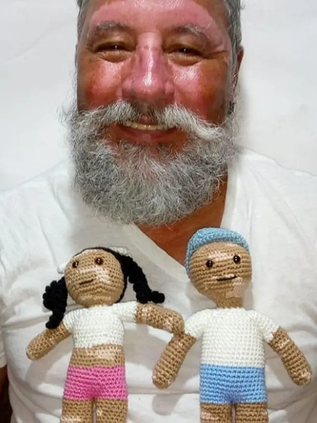 Meningkatkan PD Anak-Anak dengan Vitiligo, Pria Ini Buat Boneka Rajut Unik