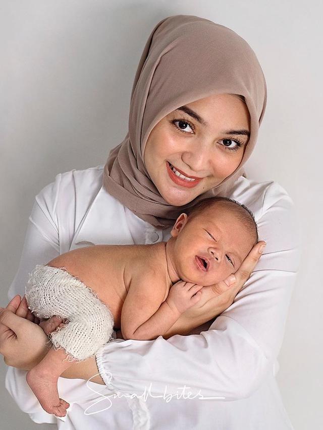 Demam Tinggi Hingga 39,6 Derajat Celsius, Citra Kirana Idap Mastitis