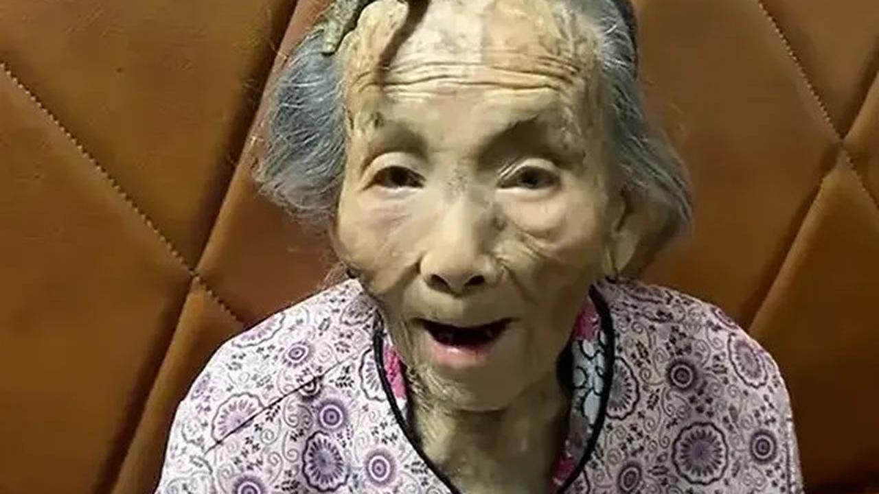 Viral Dahi Nenek 107 Tahun Ini Tumbuh Tanduk, Disebut Bikin Panjang Umur