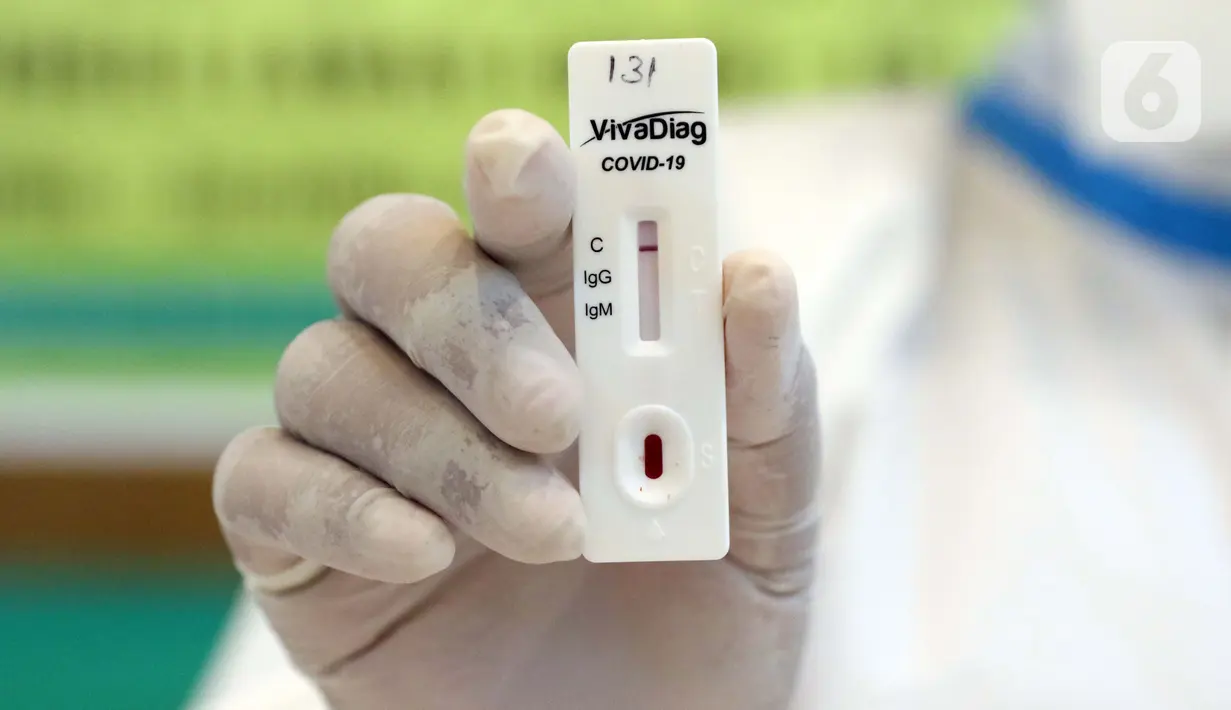 Petugas medis menunjukkan hasil Rapid Test COVID-19 di Jakarta, Rabu (8/4/2020). Hasil akan memperlihatkan adanya IgG atau IgM dalam darah. Jika ada, maka hasil dinyatakan positif. Namun, hasil tersebut bukanlah diagnosis yang menggambarkan infeksi Covid-19. (Liputan6.com/Helmi Fithriansyah)