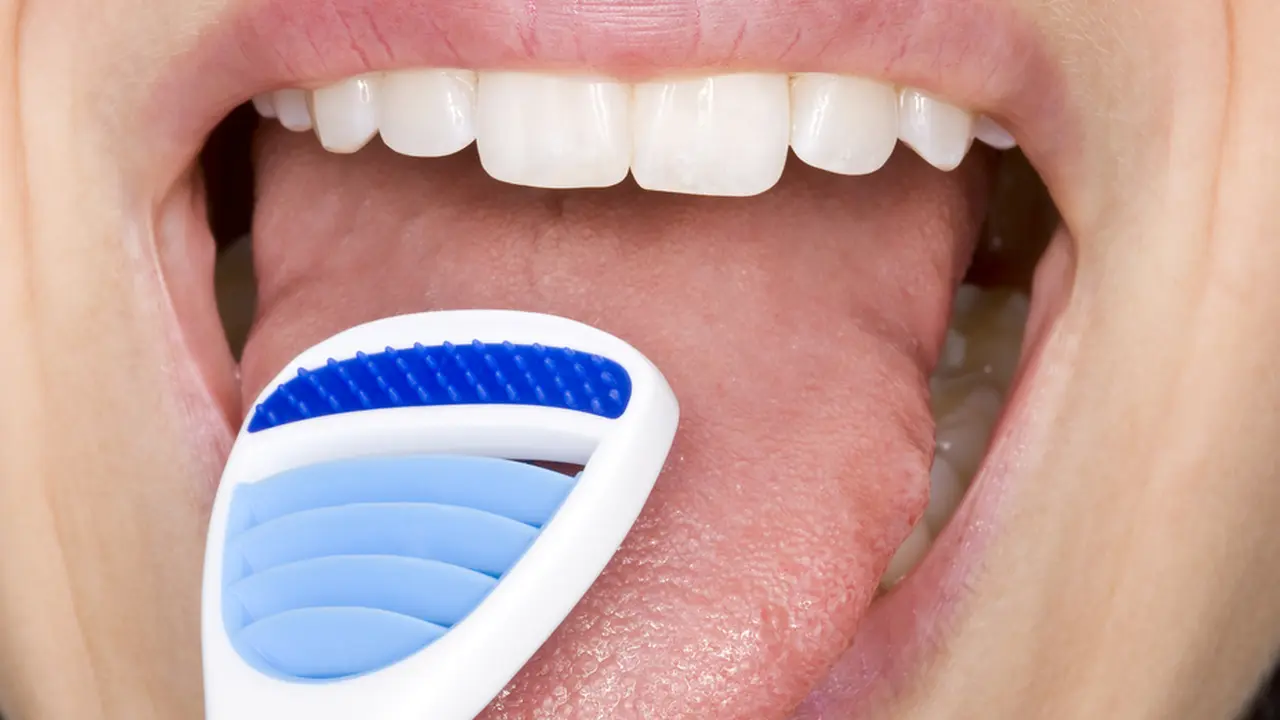 Macam-Macam Penyakit Lidah dan Cara Mengatasinya yang Tepat - Hot