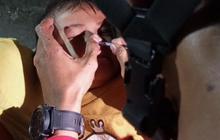 Hidung Balita di Bekasi Kemasukan Tutup Pulpen, Damkar Turun Tangan