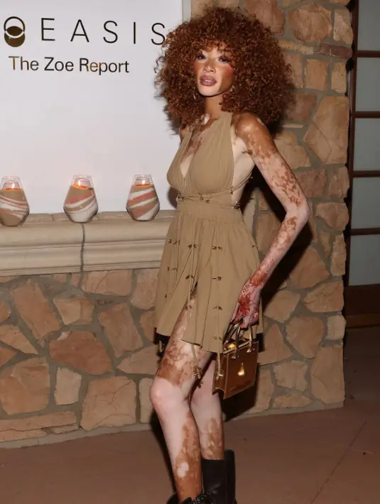 Winnie Harlow tampil dengan gaun halter bergaya safari. Nuansa khaki berhasil hadirkan gaya tropis. [Foto: Instagtam/ Winnie Harlow]