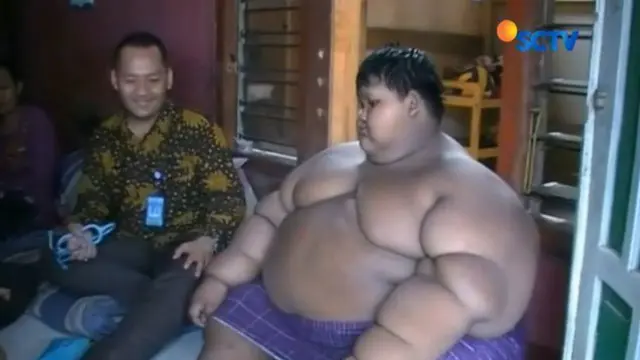 Bocah obesitas asal Karawang, Jawa Barat, Arya Permana, mengalami penurunan berat badan lima kilogram dalam dua minggu.