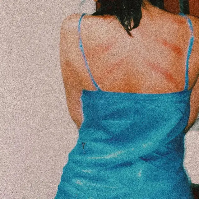 Marion Jola pamer punggung bekas kerokan (https://www.instagram.com/p/CAxxu7mJBmr/)