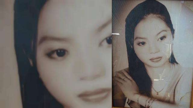 Sinus Infection Sinusitis Symptoms Causes Duration