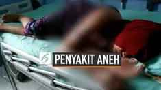 Seorang gadis di Mandailing Natal, Sumatera Utara terpaksa berhenti sekolah akibat idap sebuah penyakit aneh. Tubuhnya seperti melepuh, mengeluarkan nanah, dan disertai gatal-gatal. Lantaran tak memiliki biaya, korban hanya sempat berobat pada mantri...