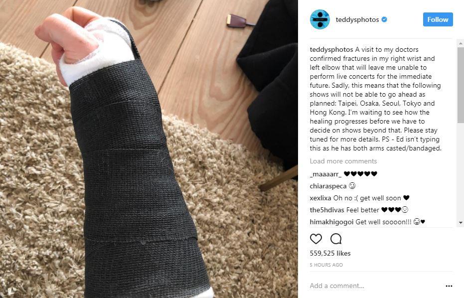 Ed Sheeran menunda jadwal konser di beberapa negara di Asia. [foto: instagram/teddysphotos]