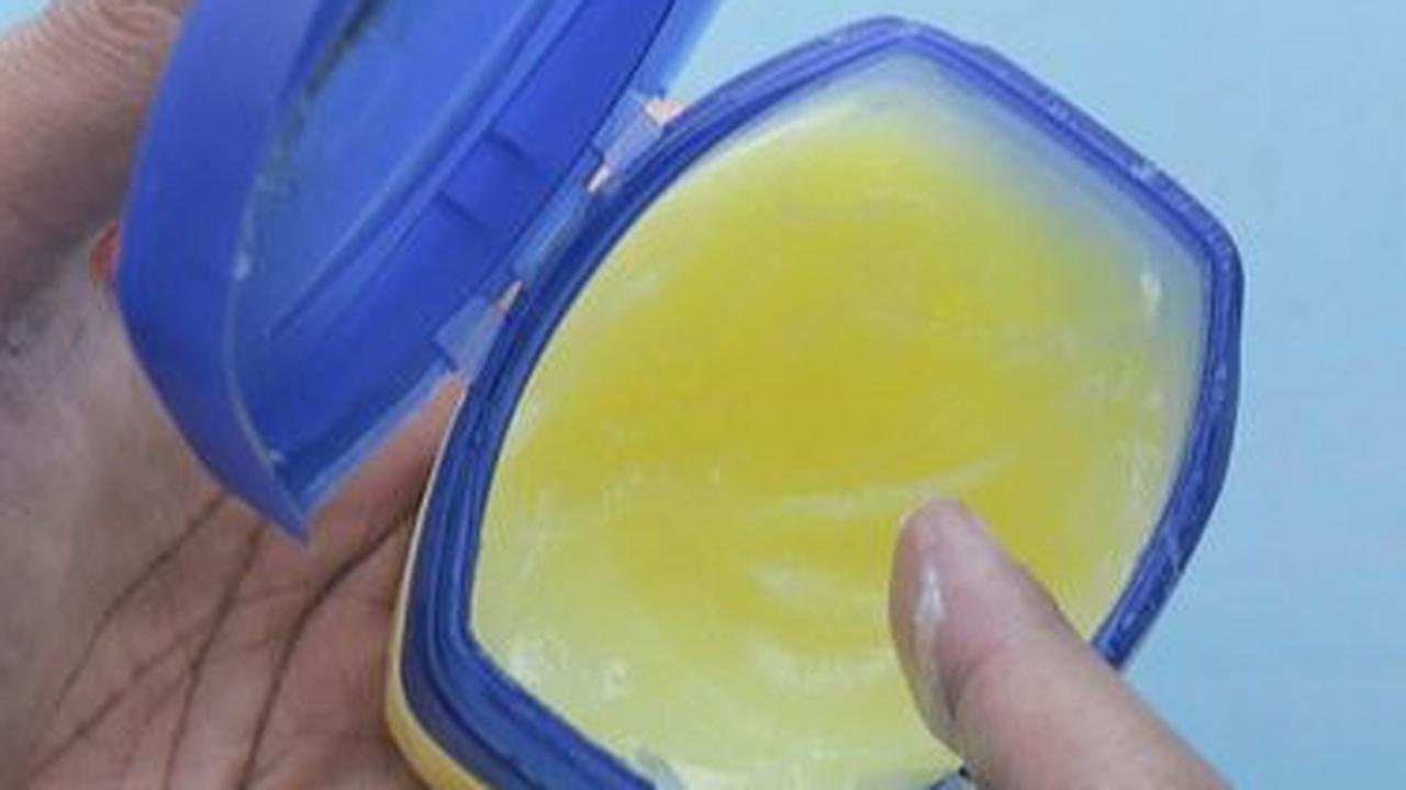 Cara Menggunakan Petroleum Jelly untuk Menghilangkan Komedo<br>