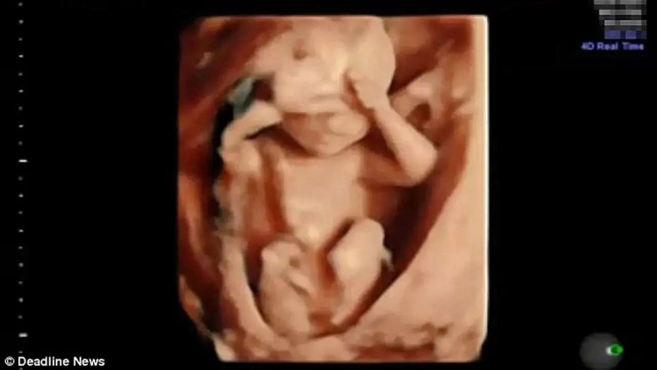 USG bayi bermain cilukba. (Deadline News)