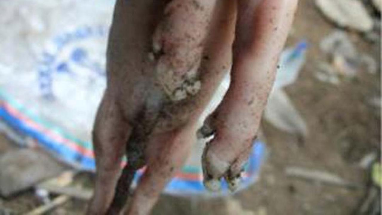 Ini wujud aneh anak babi bermata satu yang hebohkan Bali