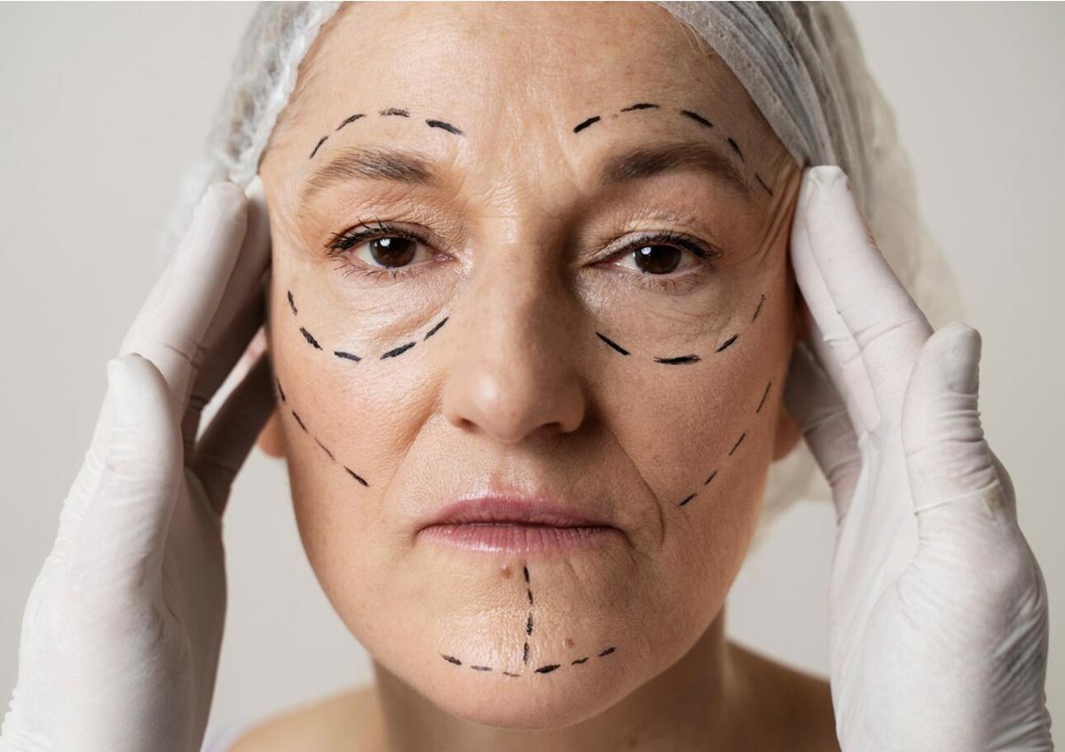 face surgery