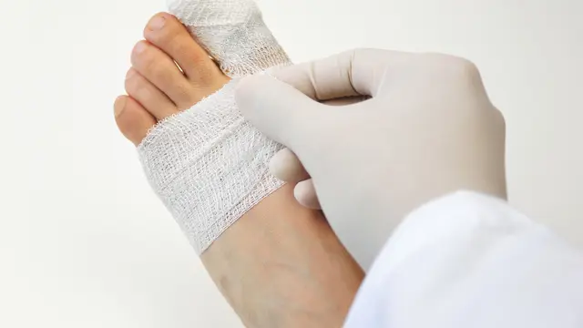 Ilustrasi kaki (iStockphoto)