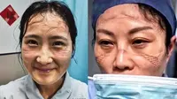 7 Potret Wajah Perawat Pasien Virus Corona di China Ini Bikin Haru
