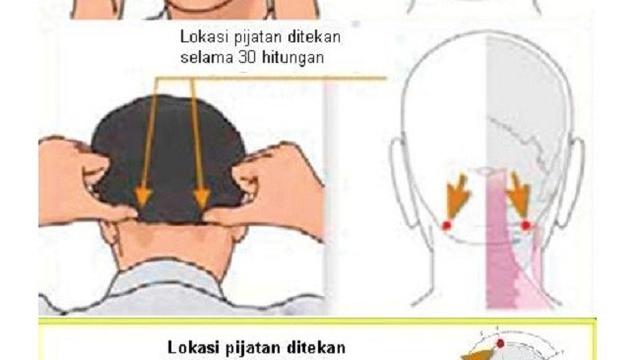 Cukup Dengan Pijat Sakit Kepala Saat Mudik Bakal Berkurang Health Liputan6 Com