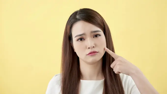 Bekas Jerawat Merah atau Hitam? Kenali PIE vs PIH Biar Nggak Salah Perawatan