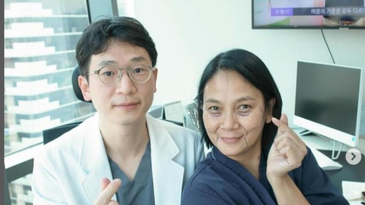 Dian Nitami Ungkap Alasan Jalani Operasi Plastik di Usia 53 Tahun