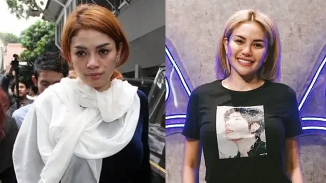 7 Transformasi Seleb Sebelum dan Sesudah Operasi Plastik, Bikin Pangling