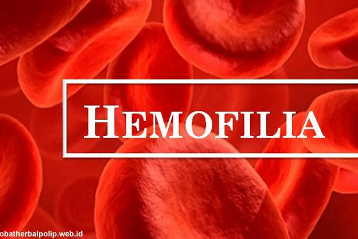 Hemofilia