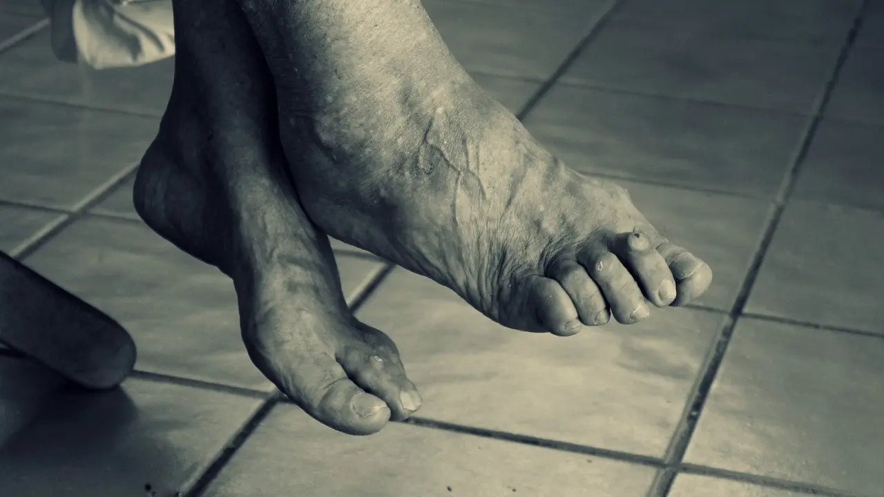 4 Cara Cegah Osteoporosis Sejak Dini, Salah Satunya Olahraga Teratur